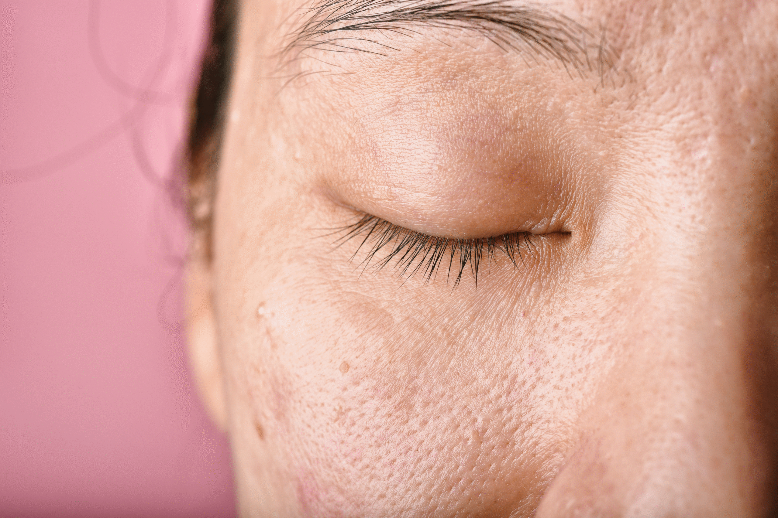 Detox giúp làm chậm quá trình lão hóa, giảm thiểu nếp nhăn
